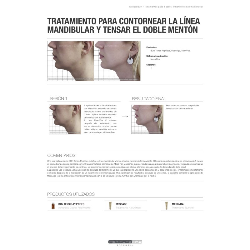 BCN Tensis Peptides Cocktail Raffermissant 5x5ml Flacons - Institute BCN - Principes actifs mésothérapie microneedling -Insti...