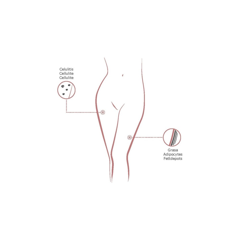 Institute BCN Packs Anti-Cellulite Mesotherapie-Set, Kosmetikprodukt -Institute BCN Packs -BCN-Pakete