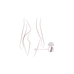 Institute BCN Packs - Mesoterapia para Gordura Localizada